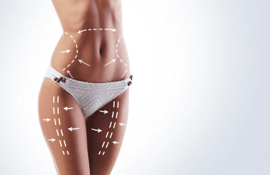 Understanding Thigh Liposuction: Is It Your Best Option for Shapely Legs?