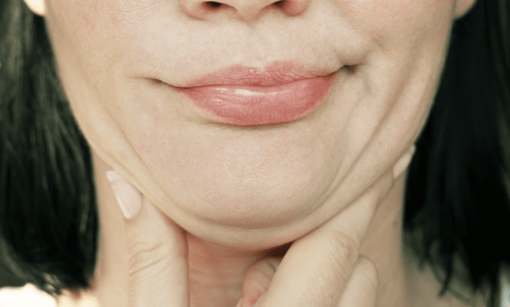 tighten skin under the chin