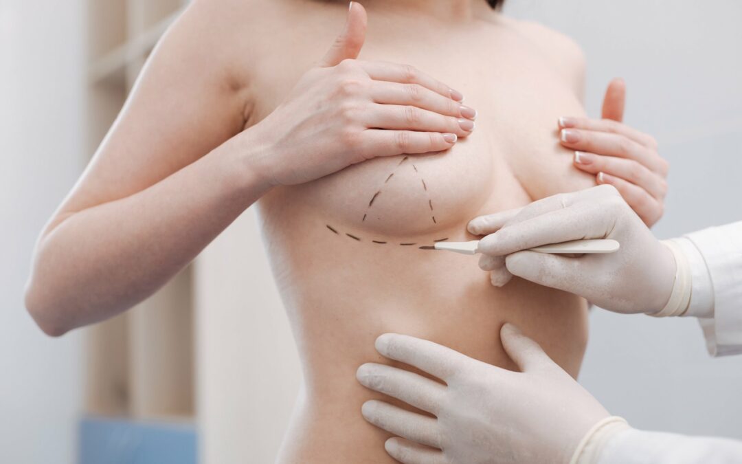 Understanding Breast Lift and Augmentation Procedures: 5 Things to Know