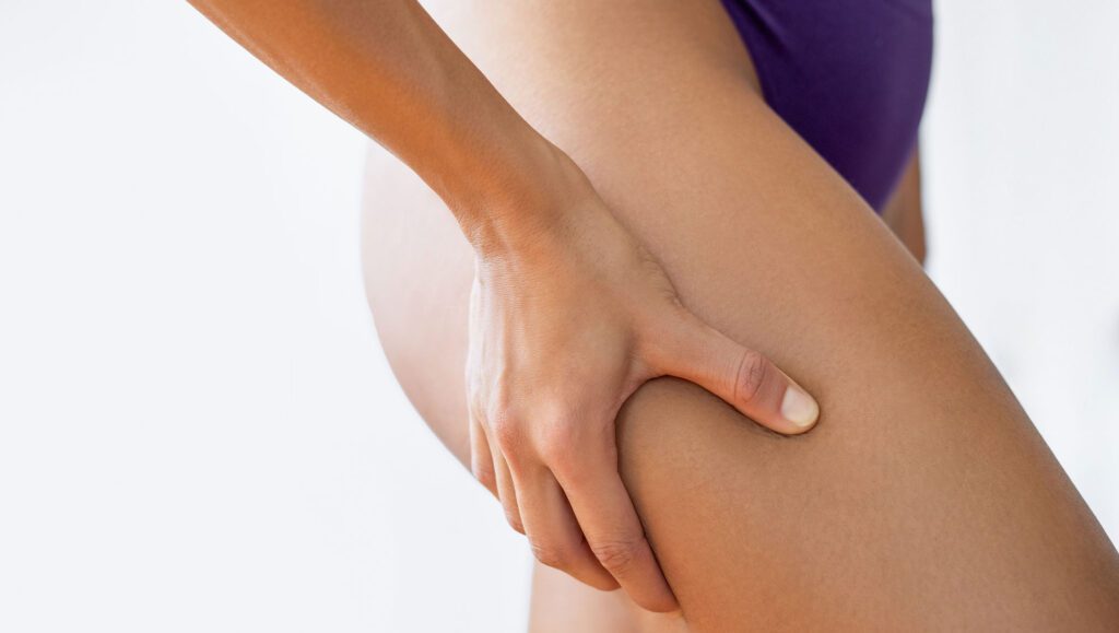 Liposuction Skin Irregularities