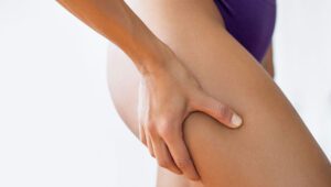 Liposuction Skin Irregularities