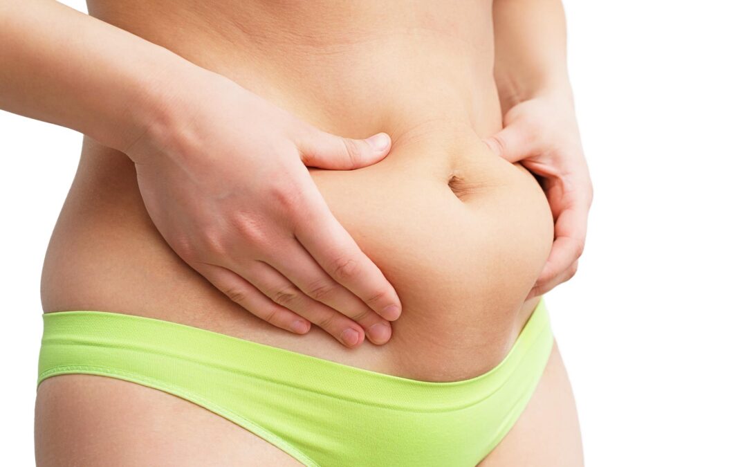 Avoid Skin Irregularities After Liposuction: Advice from Dr. Deuber