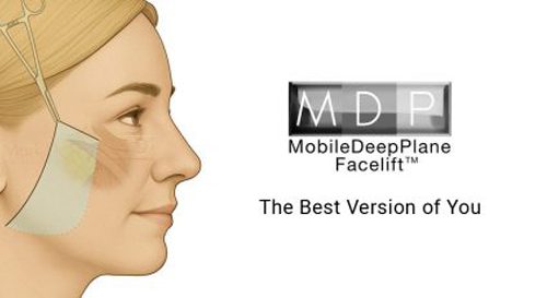 Mobile-MDP-Facelift-Banner