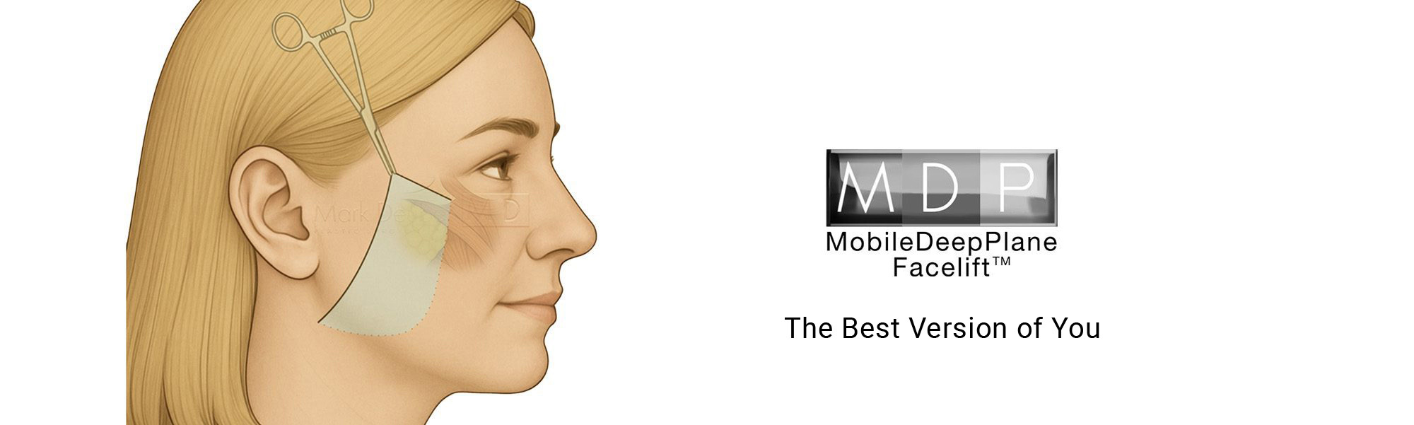 MDP-Facelift-Banner-Desktop